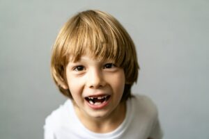 Young boy with missing baby teeth smiling, representing pediatric dental care and children's dentistry at Creve Coeur Family Dentistry.